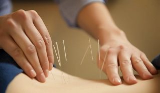 prostatit için akupunktur