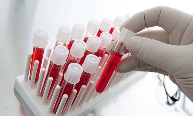prostatitli bir köpeğin analizi için test tüplerinde kan