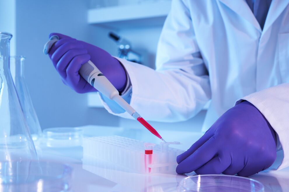 kronik bakteriyel prostatit teşhisi için kan testi